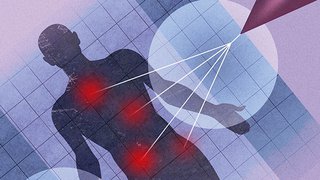 Radiation Reimagined