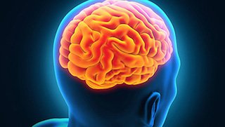Stentrievers: A game-changer in treating major strokes