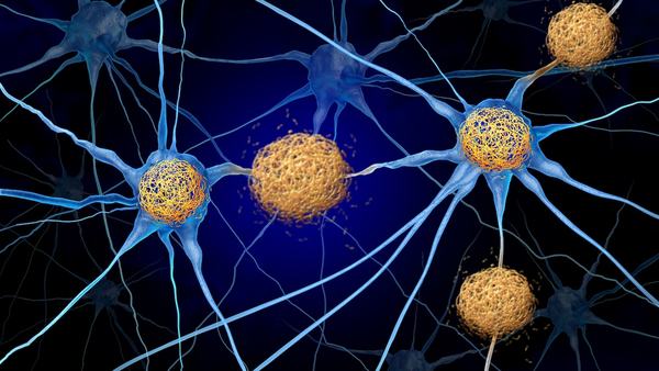 Blood tests for Alzheimer’s disease changing current, future state of dementia care