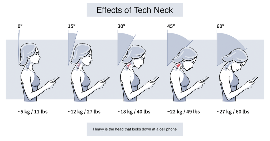 ‘Tech neck’ epidemic: How to treat the rise in chronic neck pain | Back ...