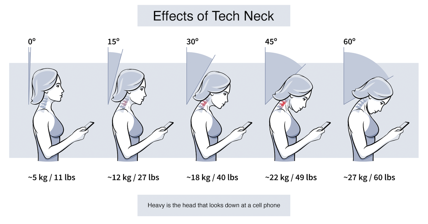 Picture of ‘Tech neck’ epidemic: How to treat the rise in chronic neck pain | Back ...