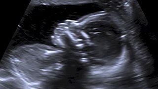 A head-to-toe tour of your baby’s ultrasound