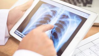 How CTEPH treatment can eliminate blood clots in the lungs