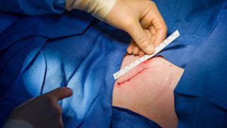 Unique Approach to Minimally Invasive Heart Valve Surgery