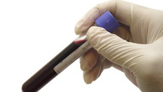 Can a simple blood test reveal a serious heart condition?