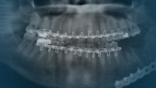 When toothache turns out to be a tumor