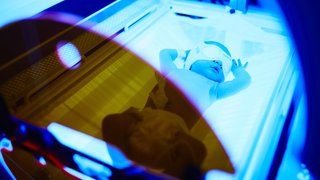4 reasons why babies get jaundice and might require immediate treatment