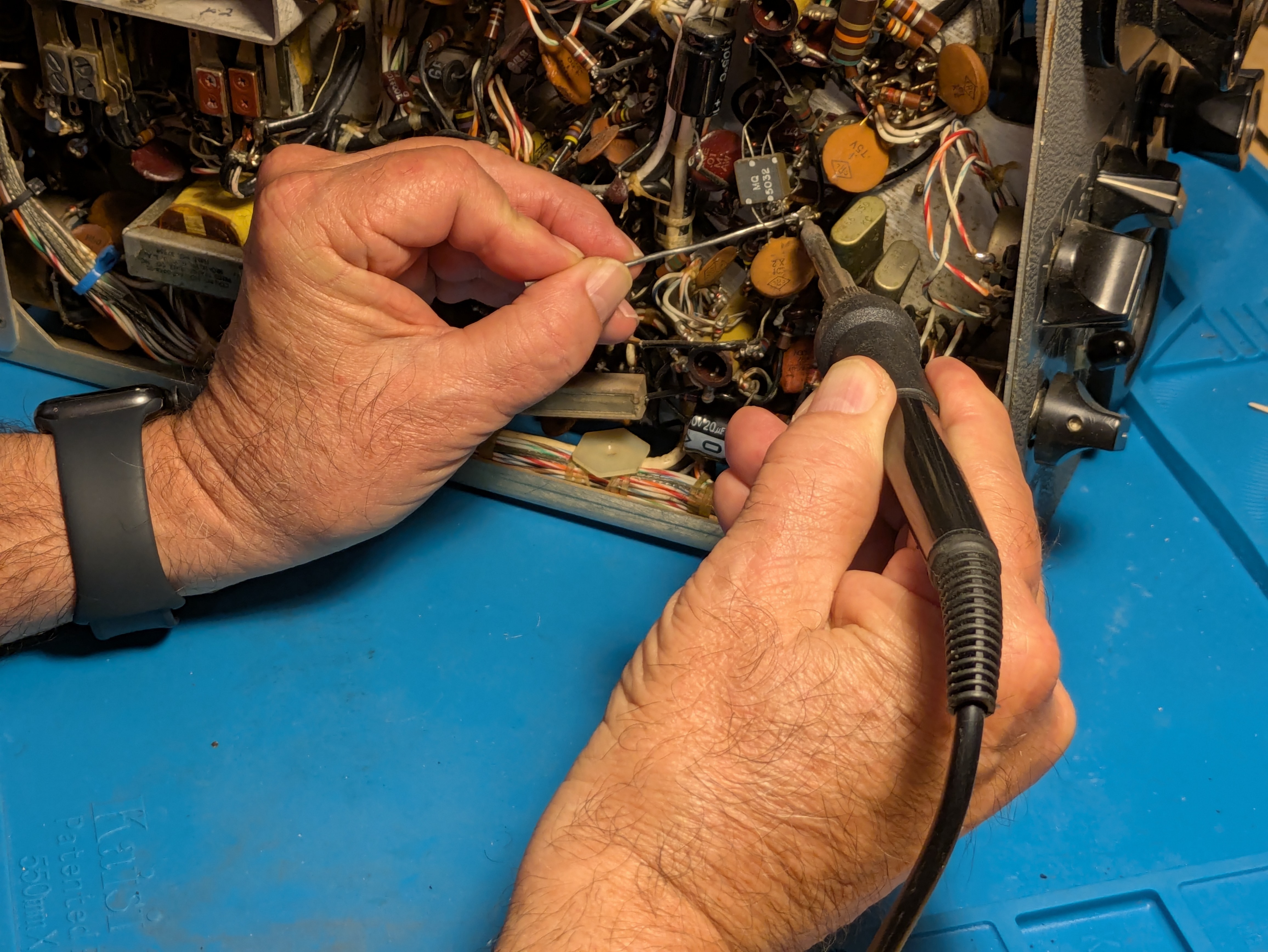 With the Parkinson's tremors in his right hand gone, Mr. Leavell has no trouble doing the fine work he loves on his ham radios.