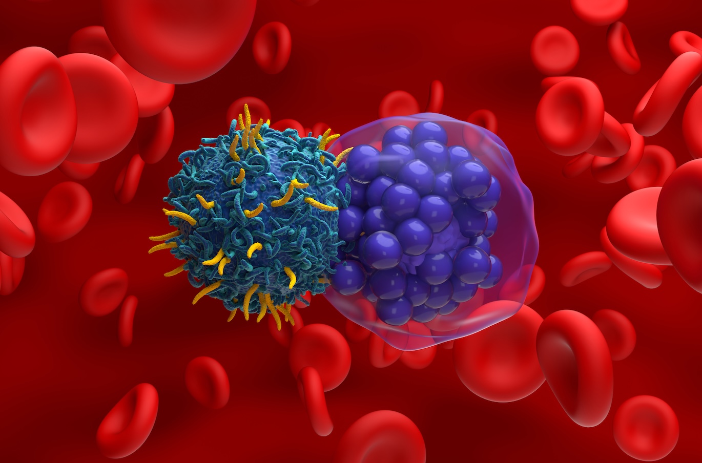 CAR-T cell therapy for diffuse large B-cell lymphoma, illustration