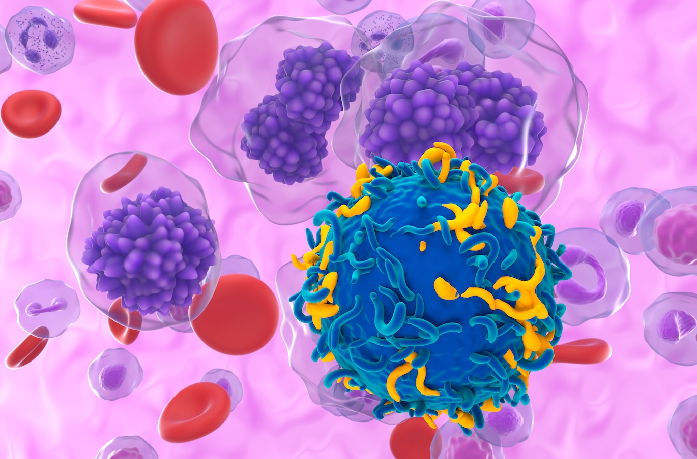 CAR-T cell therapy for plasma cell leukaemia, illustration