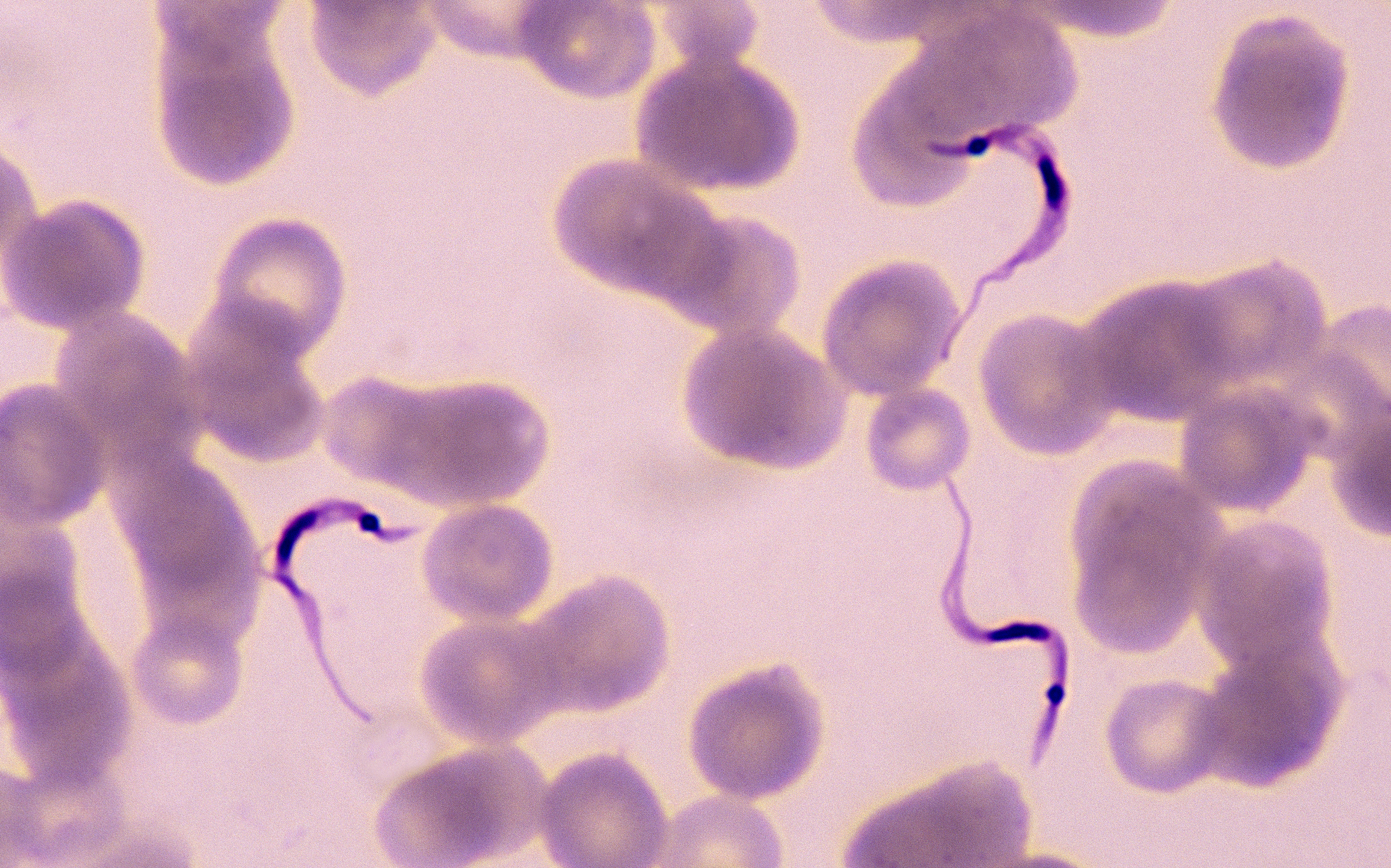 Microscopic image of Chagas disease parasite Trypanosoma cruzi.