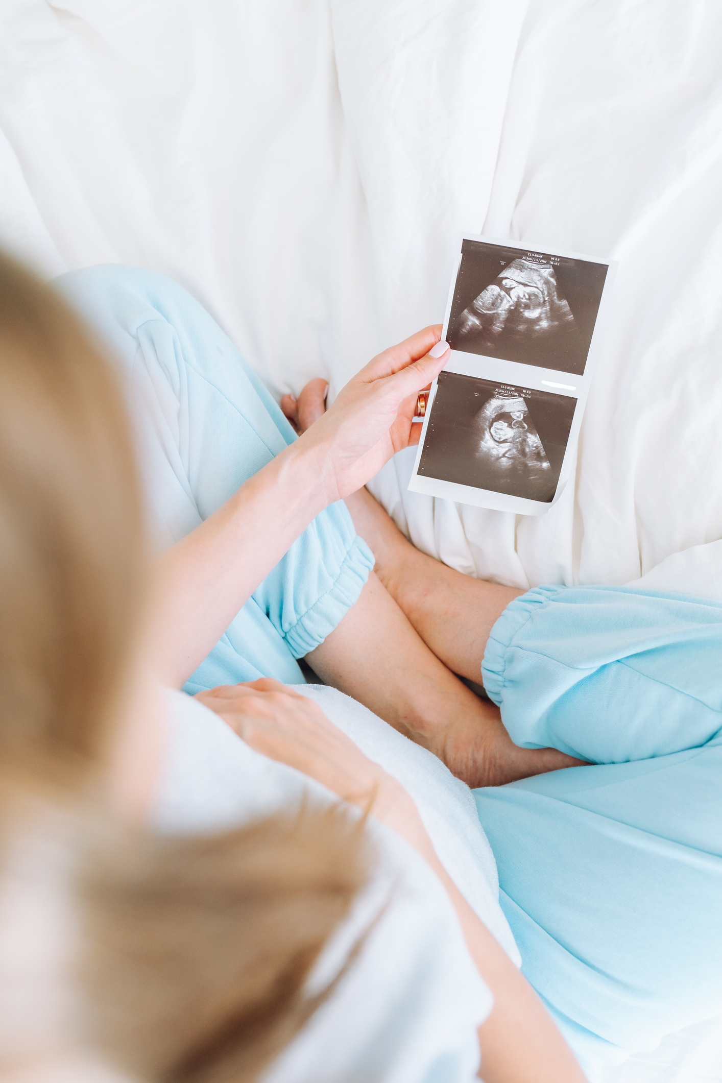 Woman cradling baby bump and holding an ultrasound image
