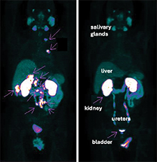 theranostics graphic