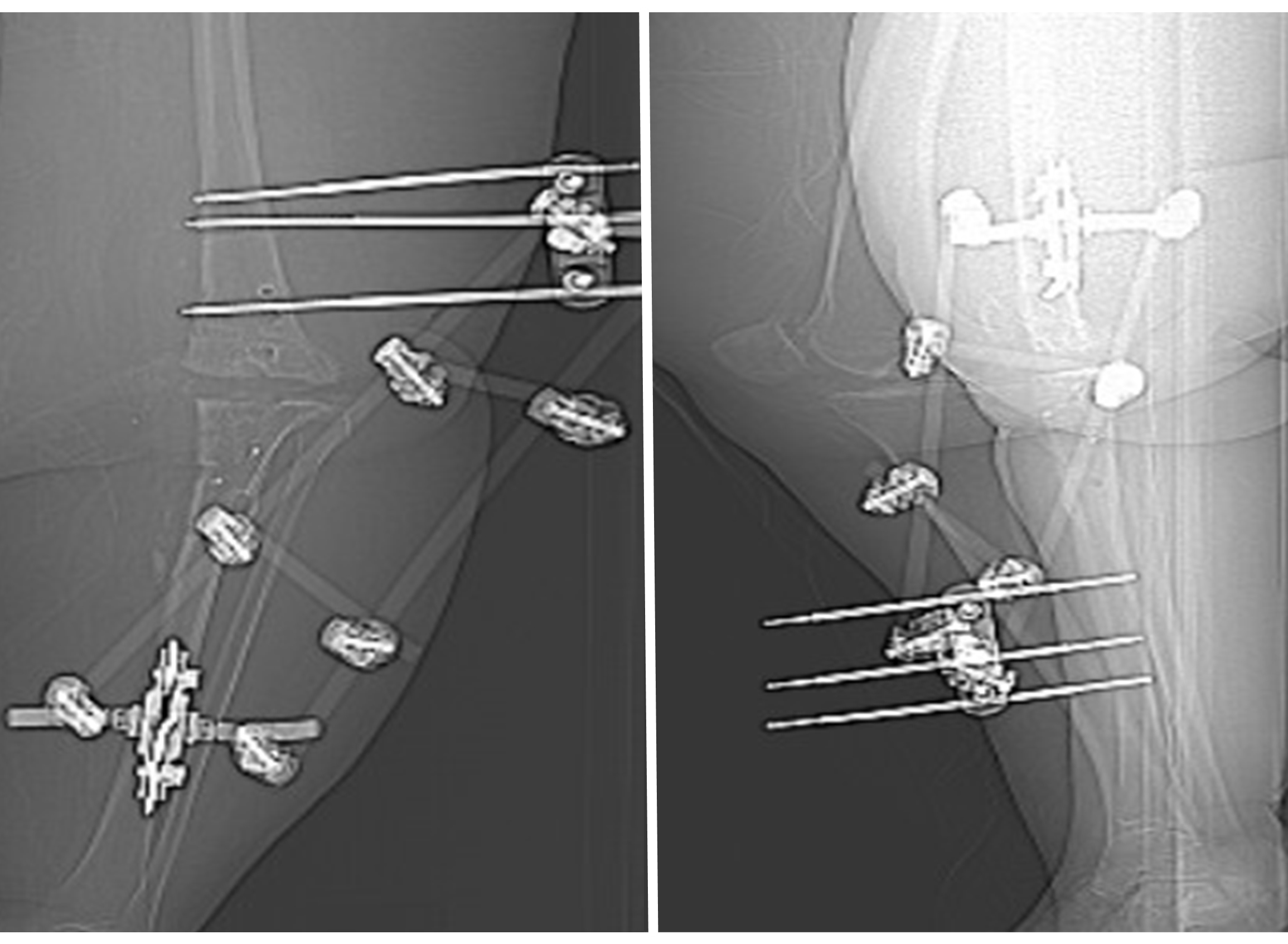A doctor reviews scan of knee with a patient
