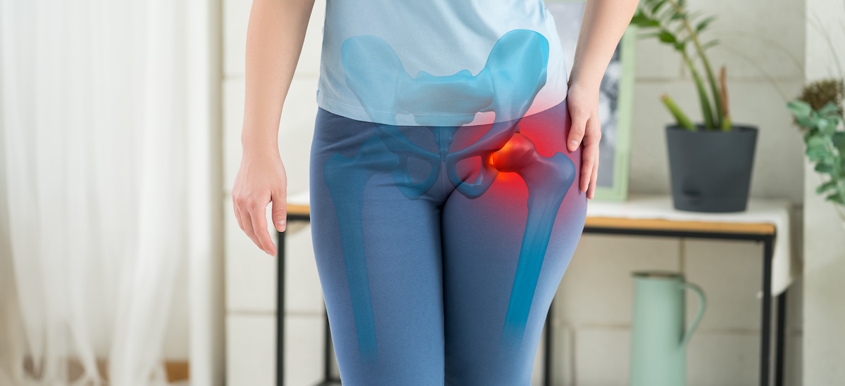 Hip Arthritis