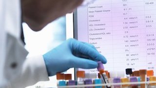 A lab technician wearing gloves is handling test tubes, with a computer screen displaying lab results in the background.