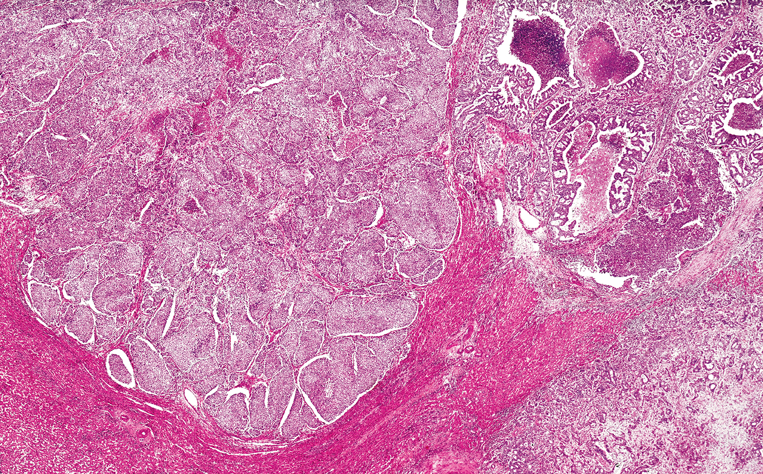 Targeting Phosphatidylserine to Boost Immunotherapy Activity