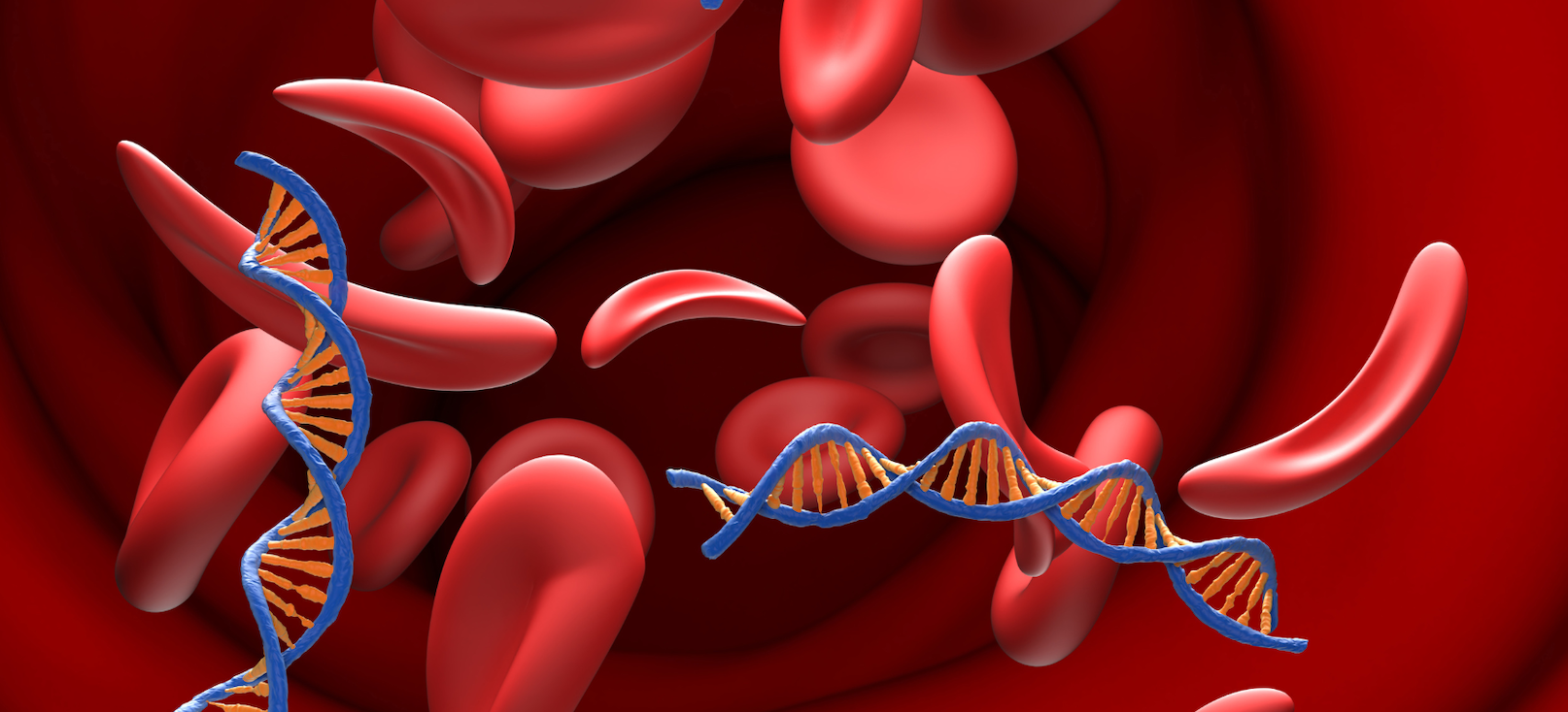 The image shows a microscopic view of blood cells, with some appearing as normal, round shapes, while others are misshapen and crescent-like, characteristic of sickle cell disease.