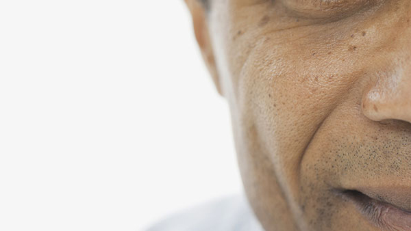 Abnormal Facial Motions