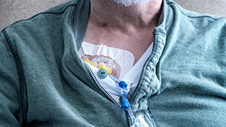 Older man with chemotherapy tubes in port