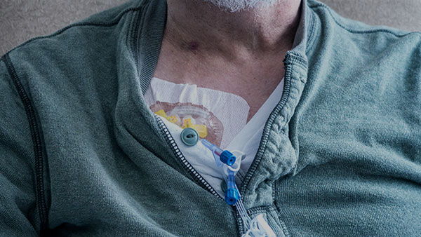 Adjuvant Chemotherapy for Stage III Colon Cancer in Healthy Patients