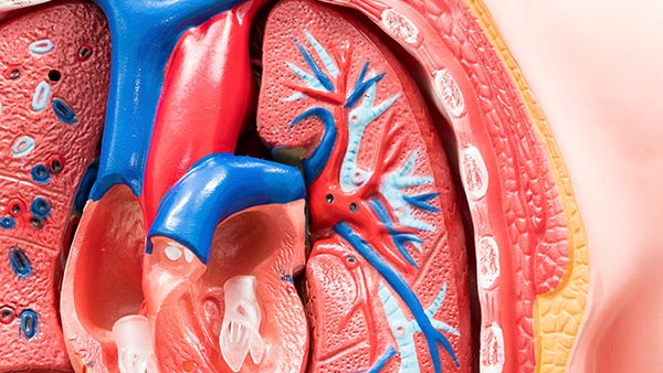 Aortic Regurgitation
