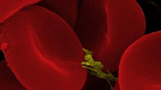 This image depicts red blood cells.