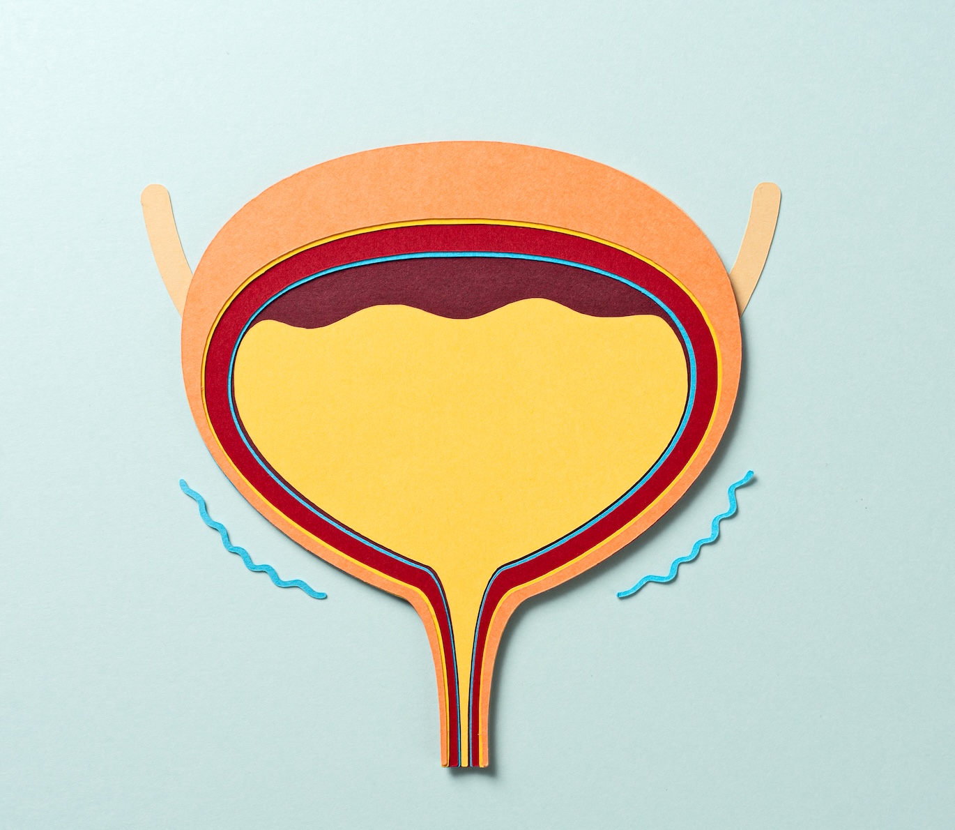 Anatomy of Human Bladder With Urine Produces Urination (illustration).