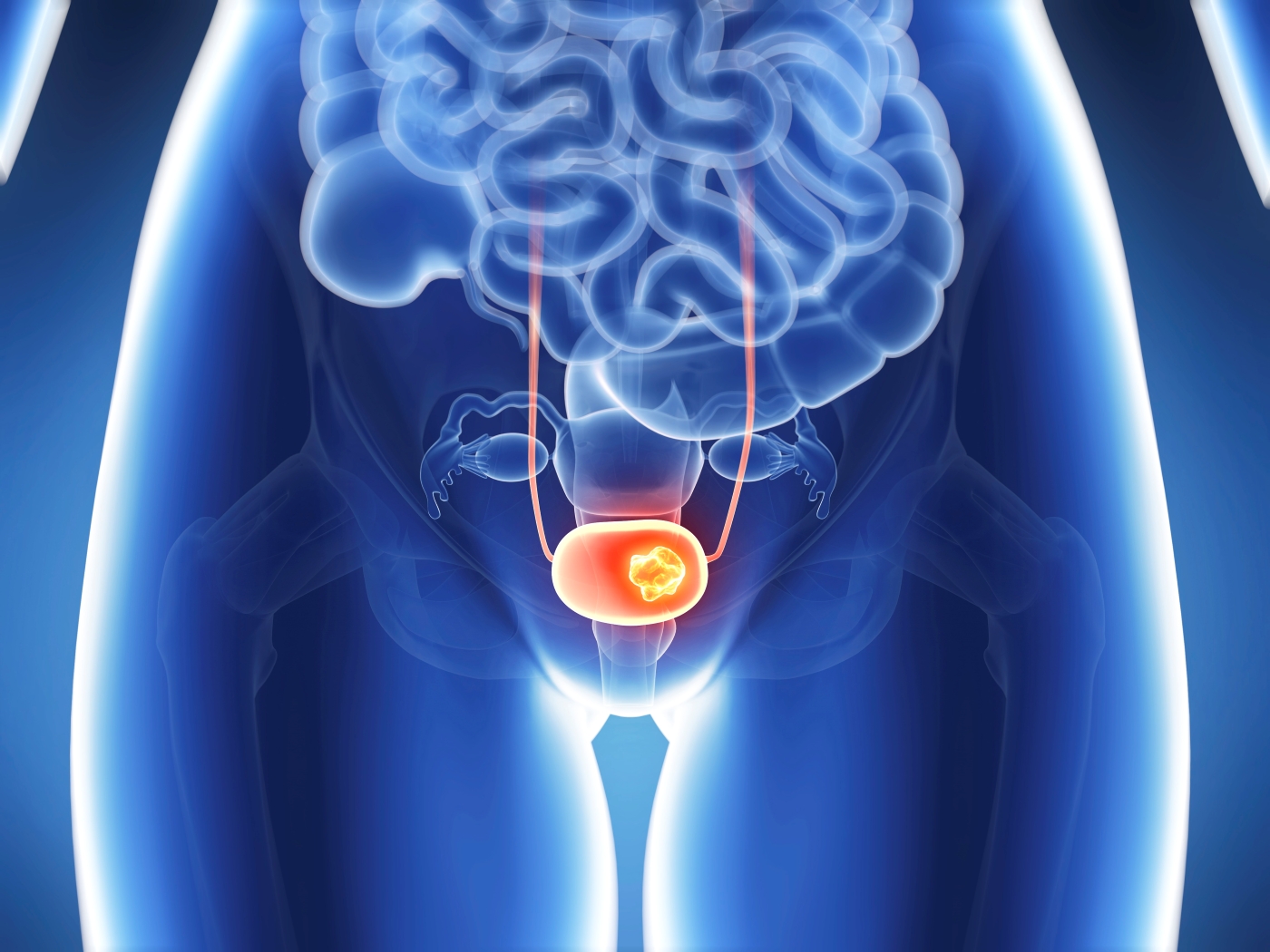 illustration showing location of bladder in body