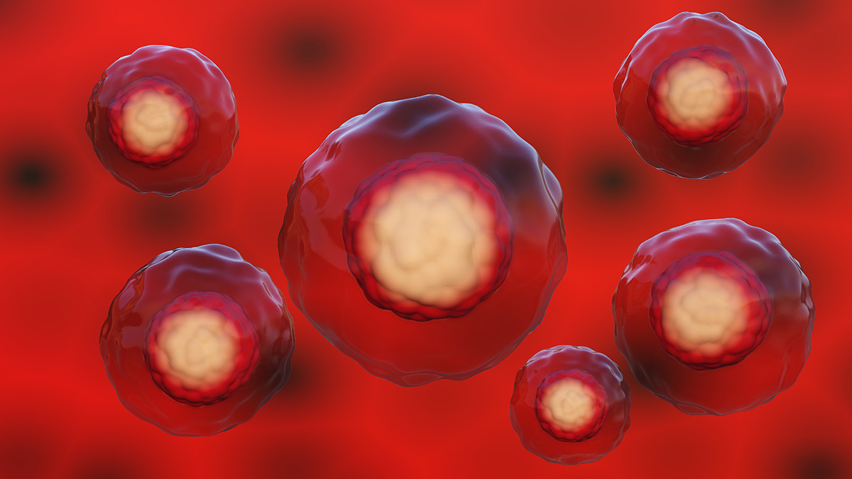 Blood Cancers/Transplant and Cellular Therapies Clinic