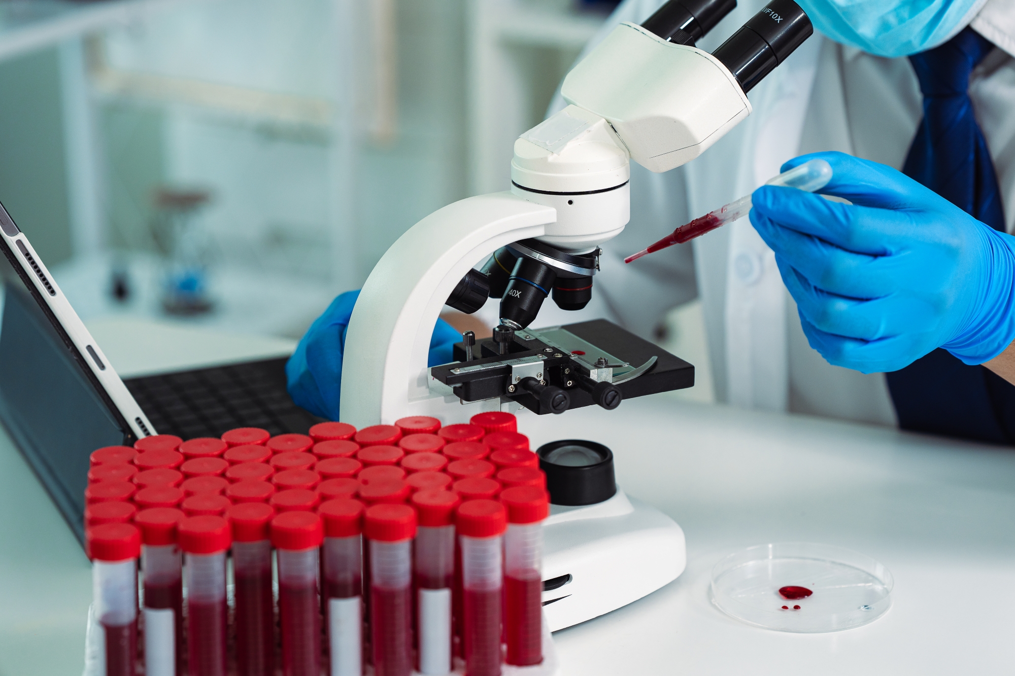 Vials of blood samples next to person looking at one sample under microscope