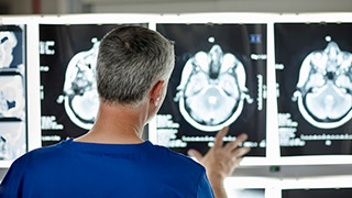 A medical professional examining brain scans on a screen.