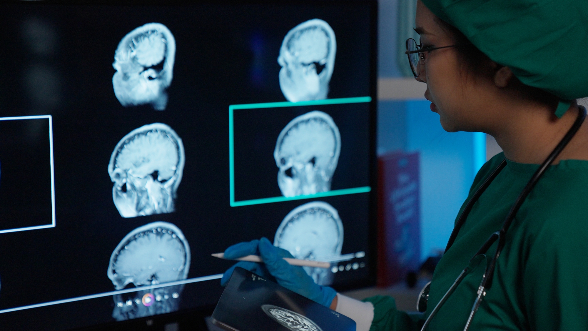 Most brain aneurysms aren’t ‘time bombs’: The right treatment may be nothing at all