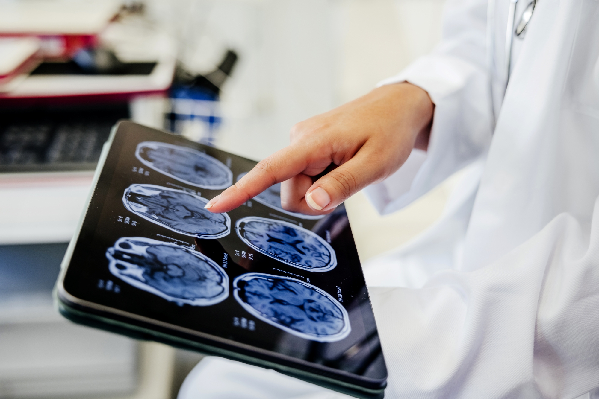A closeup view of a tablet displaying brain images