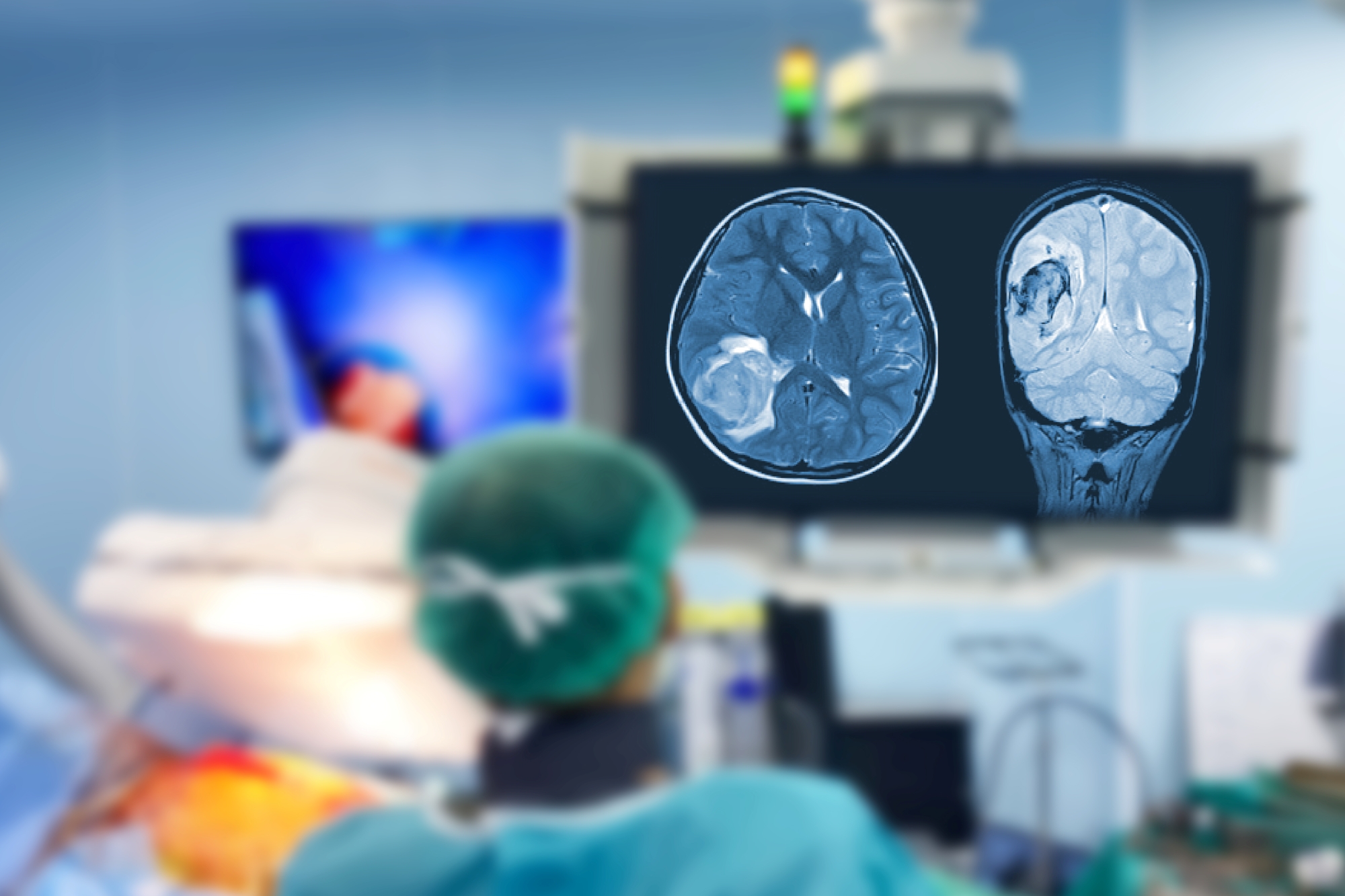 Surgeon looks at imaging of the brain