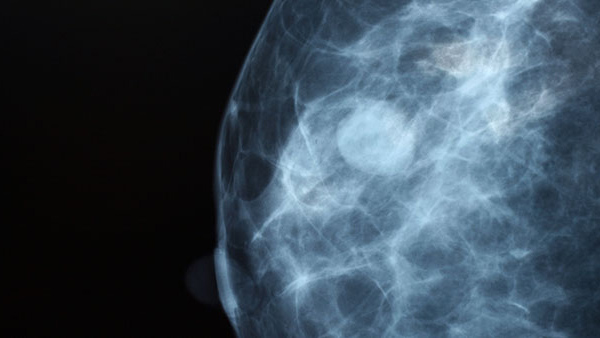 Breast Imaging