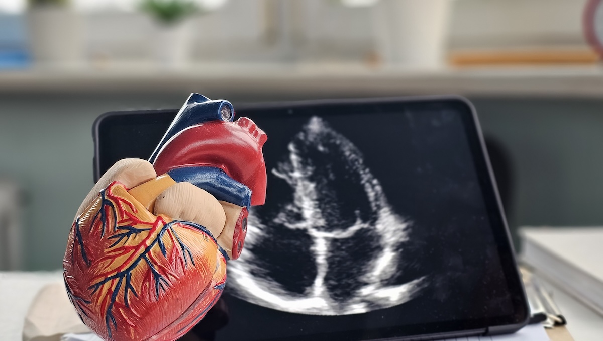 Cardio Oncology