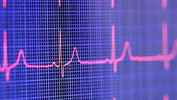 Cardiothoracic Surgery