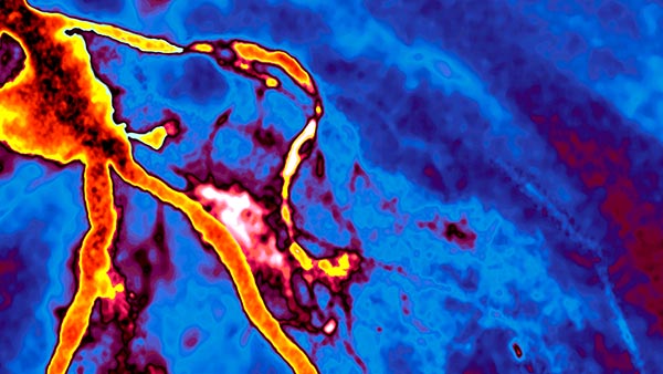 Cardiovascular Imaging