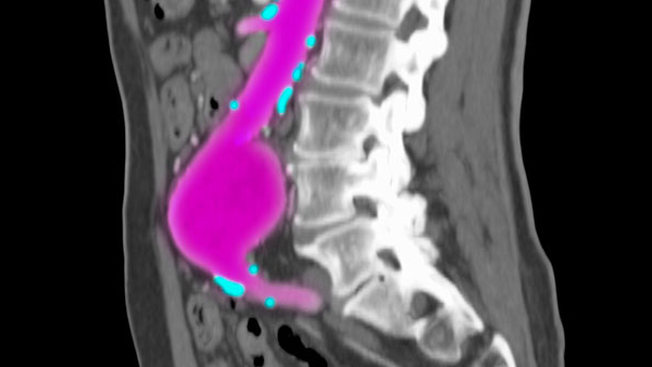 Diagnostic X-Ray Procedures