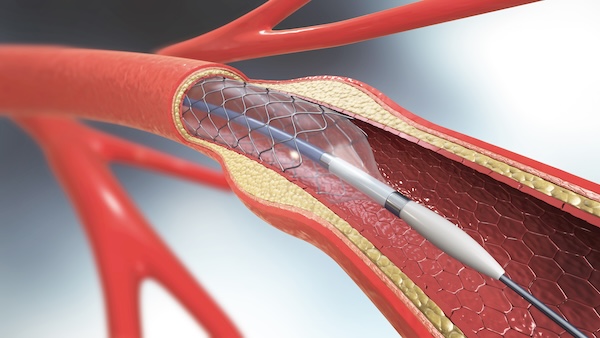 Close-up illustration of blood vessels