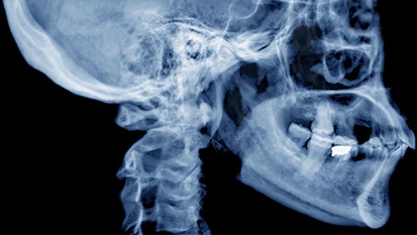 Face and Jaw Surgery (Maxillofacial Surgery)