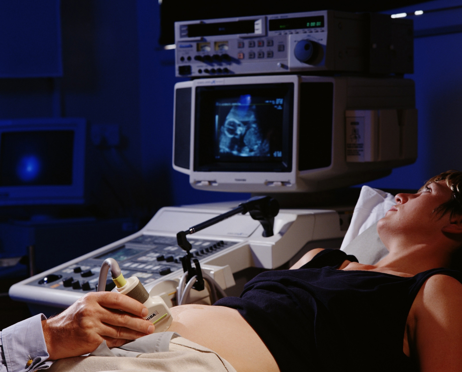 Fetal echocardiogram: What to expect
