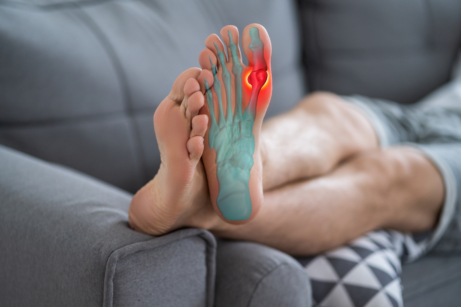 Feet propped on couch with anatomy of foot highlighting area of turf toe injury