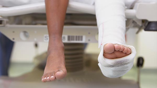 Fractures of the Upper and Lower Extremities