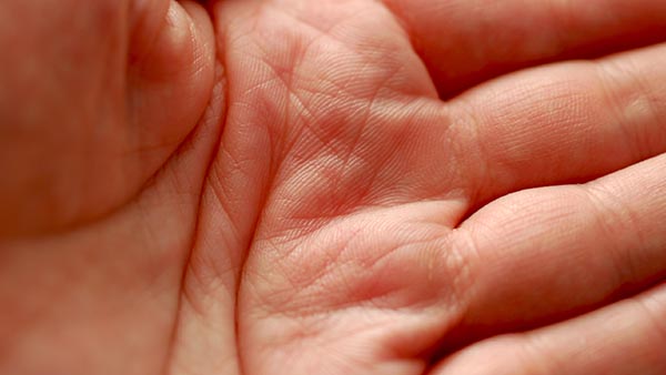 Hand, Wrist, and Elbow