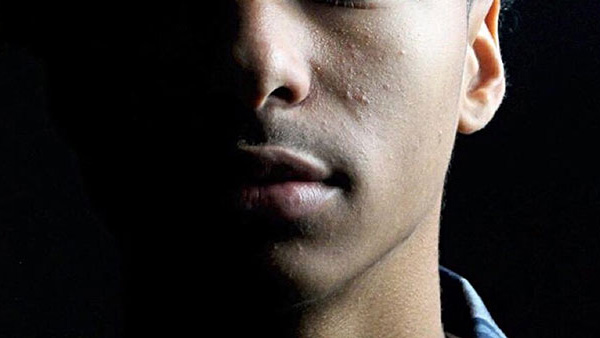 Hearing, Balance, and Facial Disorders