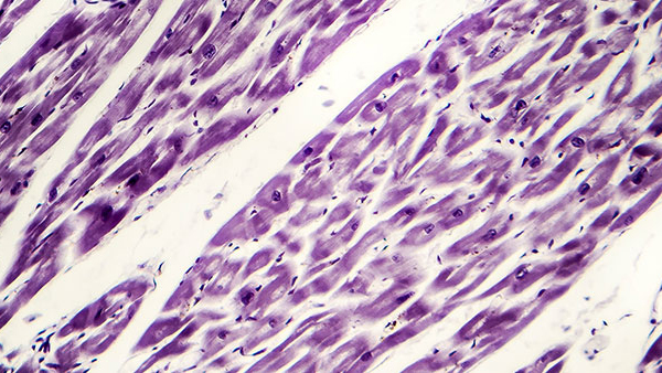 Microscopic image of heart muscle tissue