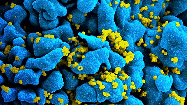 Human Immunodeficiency Virus