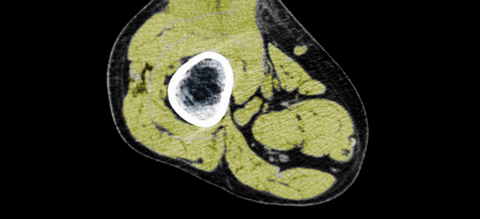 Image Here